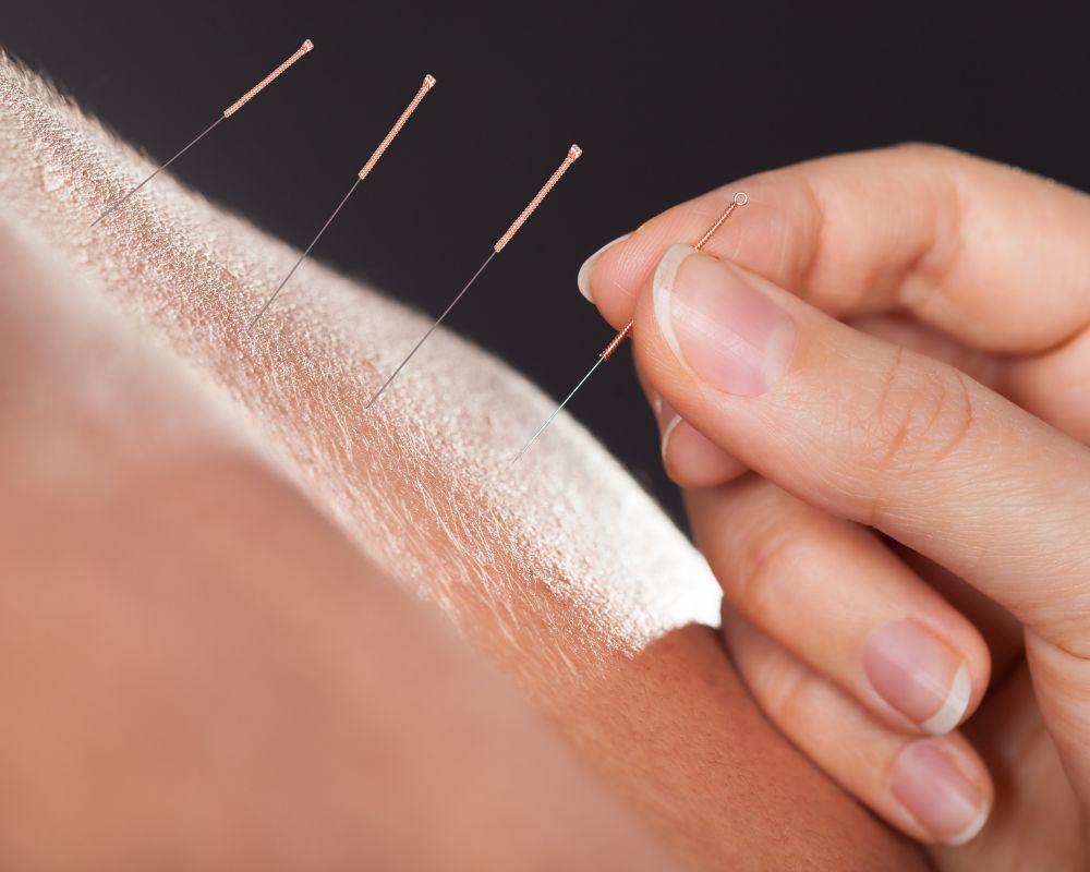 Uma agulha para o fim da Ansiedade, Depressão e “Tarja Preta”