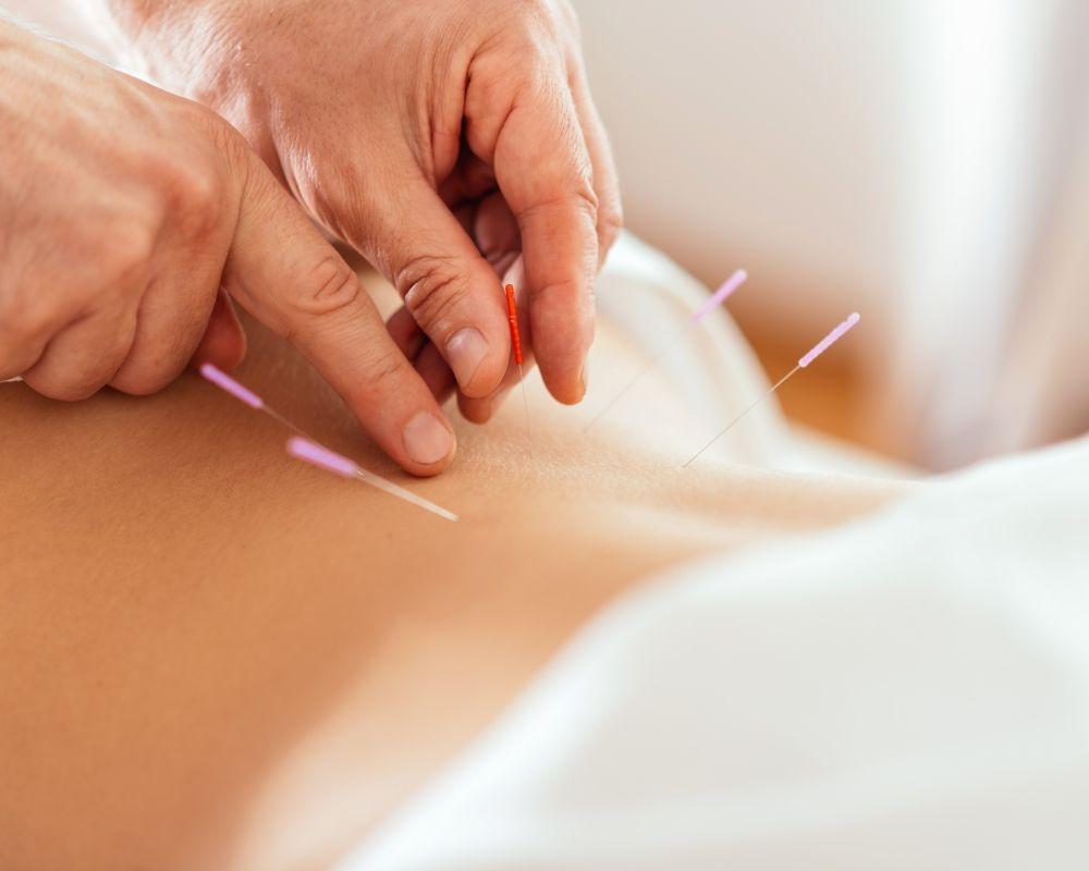 Acupuntura no tratamento de infertilidade feminina