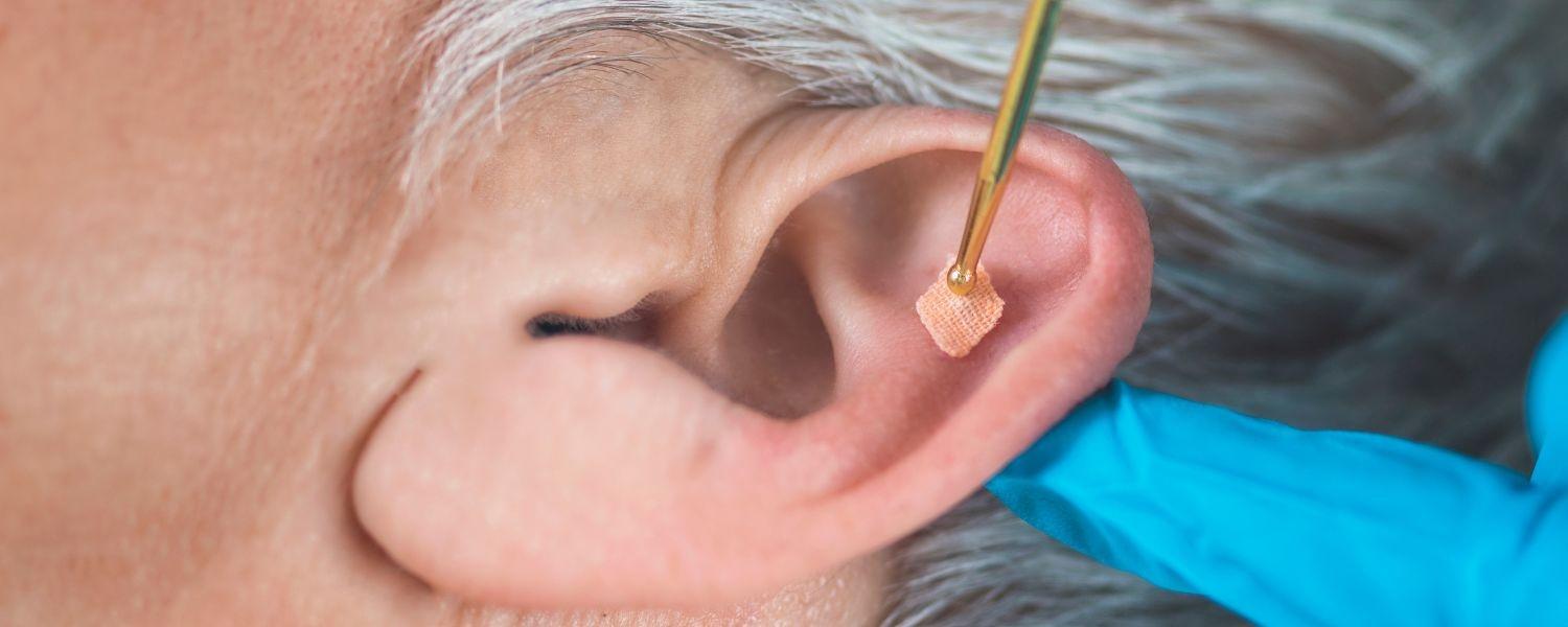 Auriculoterapia traz benefícios para a saúda do corpo e da mente